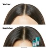 L'Oréal Professionnel Hair Shampoo for Soothing Sensitive Scalp, Scalp Advanced,