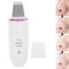 Ultrasonic Skin Scrubber Blackhead Removal Pore Cleaning Face Spatula for
