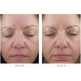 Obagi Medical Obagi 360° Crema Con Retinol 0.5% 28g