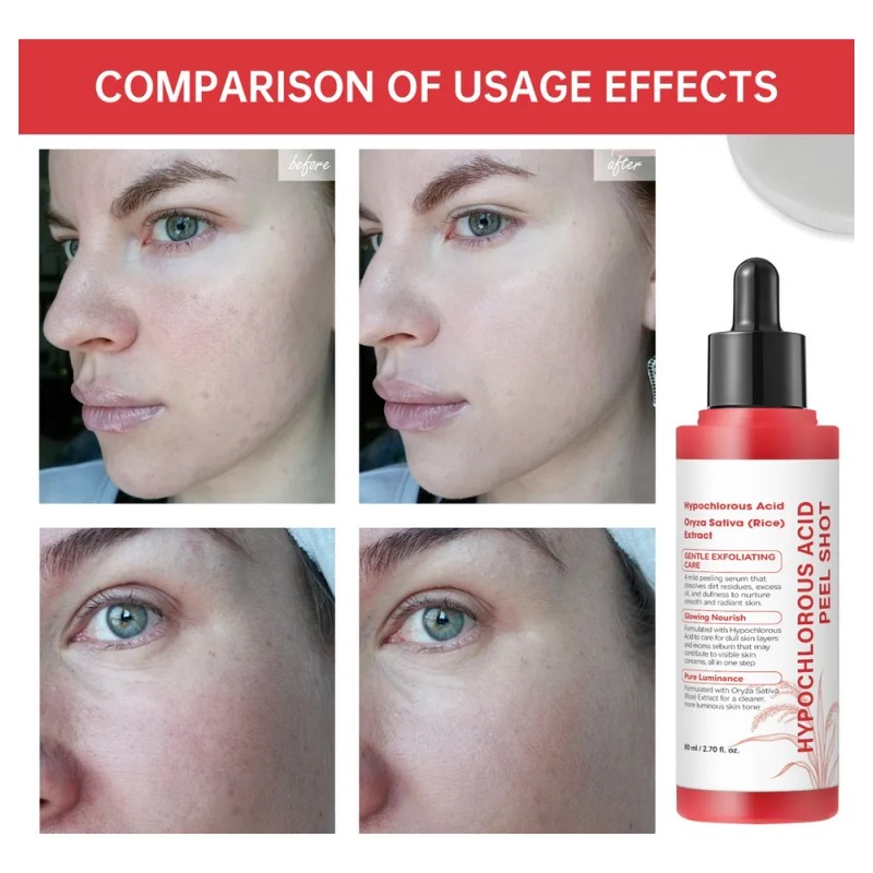 Face Conditioning Aceite Desincrustante Spa + Rostro Esencia Todo Tipo