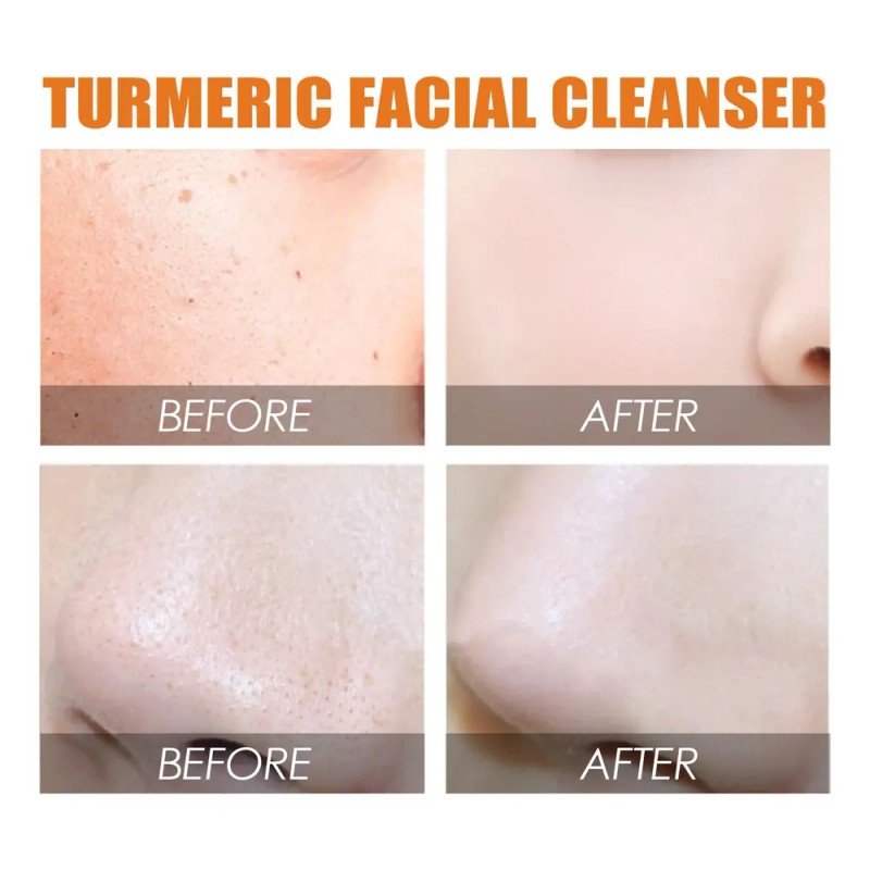 Limpiador Facial Con Cúrcuma Eelhoe Para Una Limpieza E Hidr