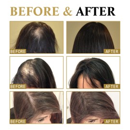 Batana Oil,Raw Batana Oil for Hair,Raw Ba/tana O/il Hair Treatment Cream,Bat/ana O/i/l for H/air Growth,Organic Bata/na Hair Growth Butter,Hai/r O/ils,Batan/a Ha/ir Oi/l,Hai/r Repair Mask