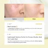 Crema Facial Dr. Althea 345 Relief Coreana Con Niacinamida