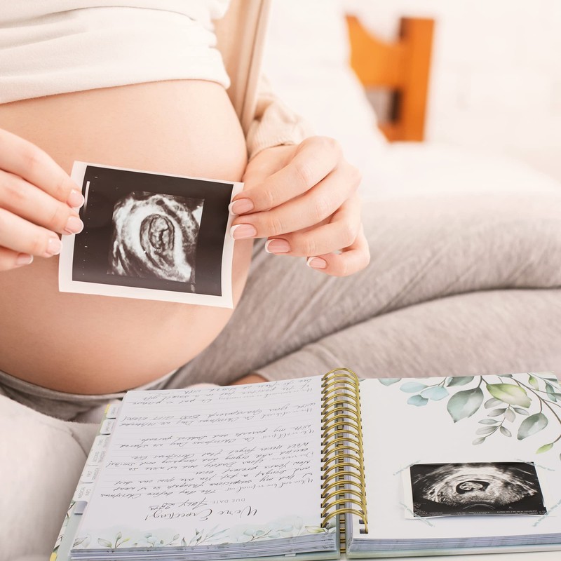 ZICOTO ZICOTO Pregnancy Journal and Memory Book with Stickers and