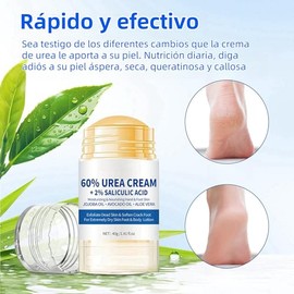 KIZCGE Crema Hidratante con Urea 60 para Pies, Manos y Codos - Exfoliante para Piel Seca, Agrietada y Callosidades (40g)