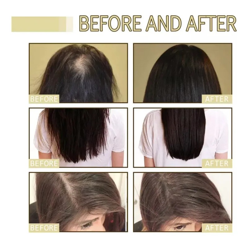 60ml*3 Aceite Vegano Natural Para El Crecimiento Del Cabello
