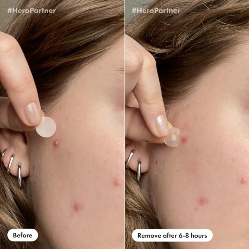 Paquete Patch Duo Mighty Patch Para Día Y Noche, 36