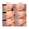 Lifting Mask - Chin Slimming Mask V Shape Lifting Mask