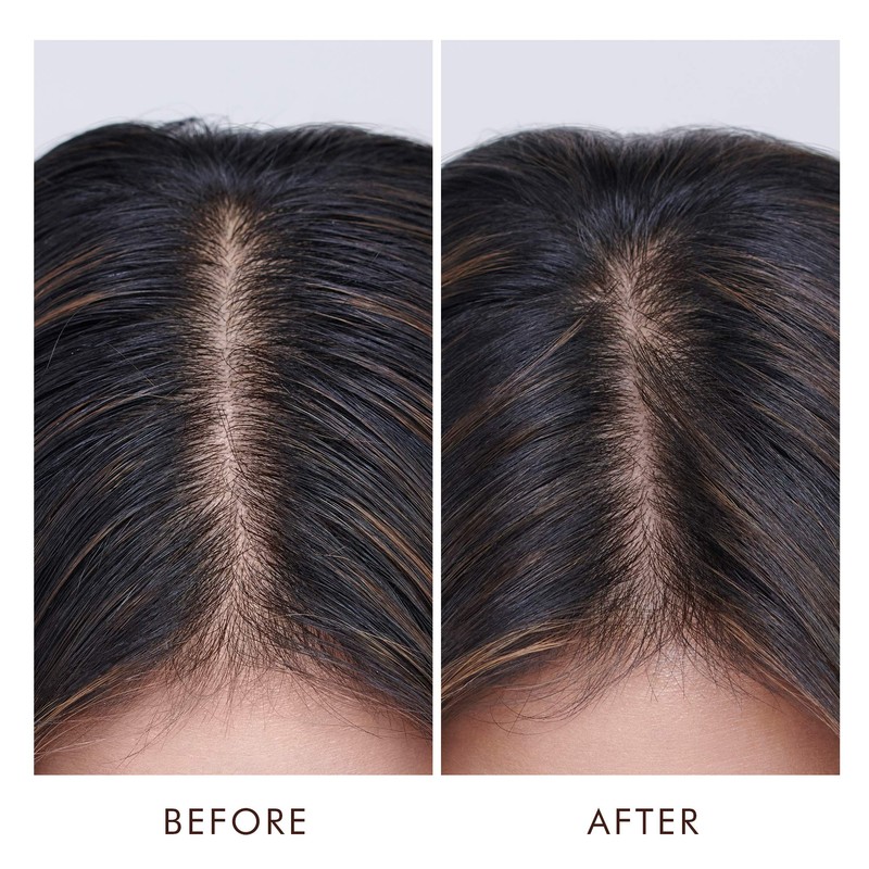 Moroccanoil Treatment for Oily Scalp, 45 ml