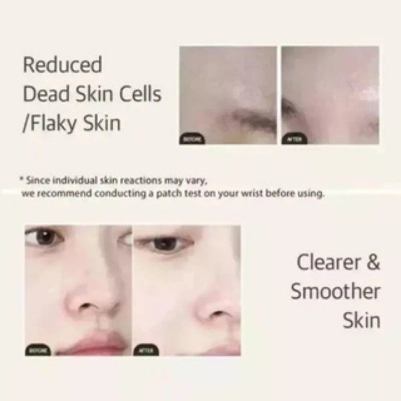 2x Caracol Exfoliante Facial Mixsoon Essence Con Esencia