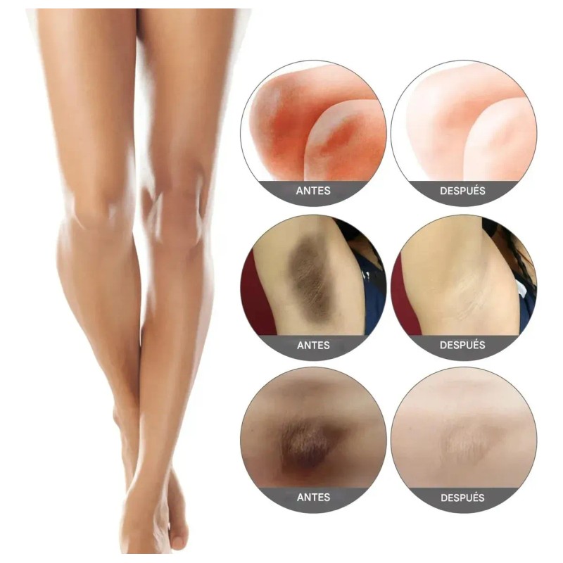 Crema Blanqueadora Iluminadora Axilas Rodillas Codos Muslos Internos Línea Bikini