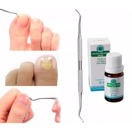 ARABELA UÑAS ENCARNADAS TRATAMIENTO ABLANDADOR Y LEVANTADOR DE UÑAS SET DE 2 PIEZAS