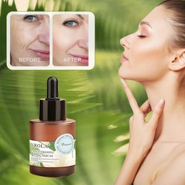 O'ROLA Retinol Firming & Lifting Serum with Retinol & Niacinamide - Anti aging Glow Serum for Wrinkles, Fine Lines, Blemishes & Dark Spots