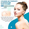 Silicone Scar Sheets, Silicone Scar Tape(1.8”x 157” Roll-4M), Silicone Scar