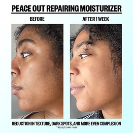 PEACE OUT- Hidratante reparador para el cuidado de la piel, 1,7 fl oz