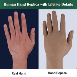 Ultrassist IV Practice Kit Dark Skin with Latex-Free Veins, Venipuncture IV Injection Training Hand for Nursing Students