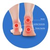 Achilles Tendonitis Support Insole | Slimflex Simple Full Length |