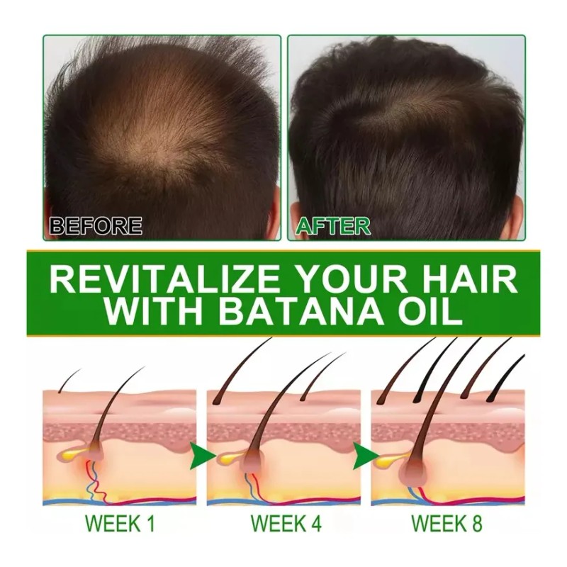 Aceite De Batana Para El Crecimiento Del Cabello - 118ml