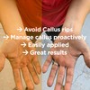 Callus Performance Healing Salve | Helps Heal callous Rips on
