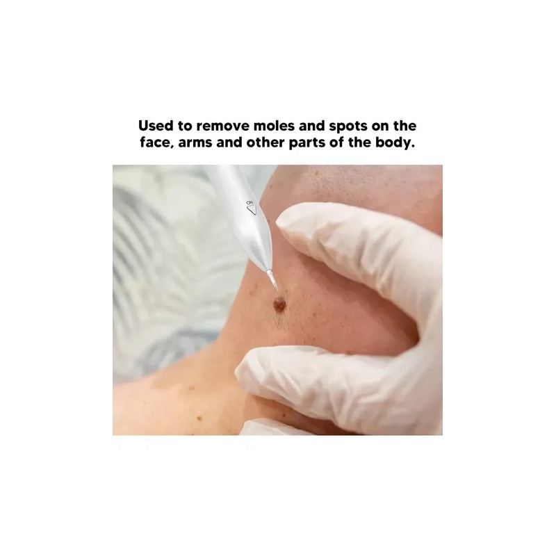 Herramienta Para Quitar Verrugas Condilomas Vph Zona Bikini