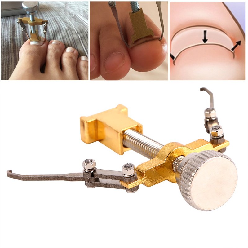 Ingrown Toenail Corrector, Practical Ingrown Toenail Tool Nail Kit Toe