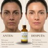 Suero Facial Antioxidante con Vitamina C + Ácido Hialurónico +