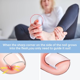 Toenail Correction, Ingrown Toenail Correction Set, 40 Pieces Painless Toenail Smoothing Strips with Toenail Lifter, for Treating Ingrown Toenails