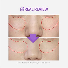 SUNGBOON EDITOR [SUNGBOON EDITOR]Meoru Podo VitaC Dark Spot Pad (60ea)