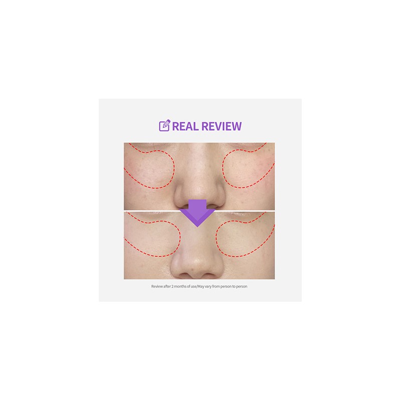 SUNGBOON EDITOR [SUNGBOON EDITOR]Meoru Podo VitaC Dark Spot Pad (60ea)