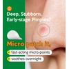 Troubless Micro-Point Patch Plus Limited Value Pack - Thin Hydrocolloid