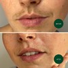 NAD's 20 Piece Facial Wax Strips