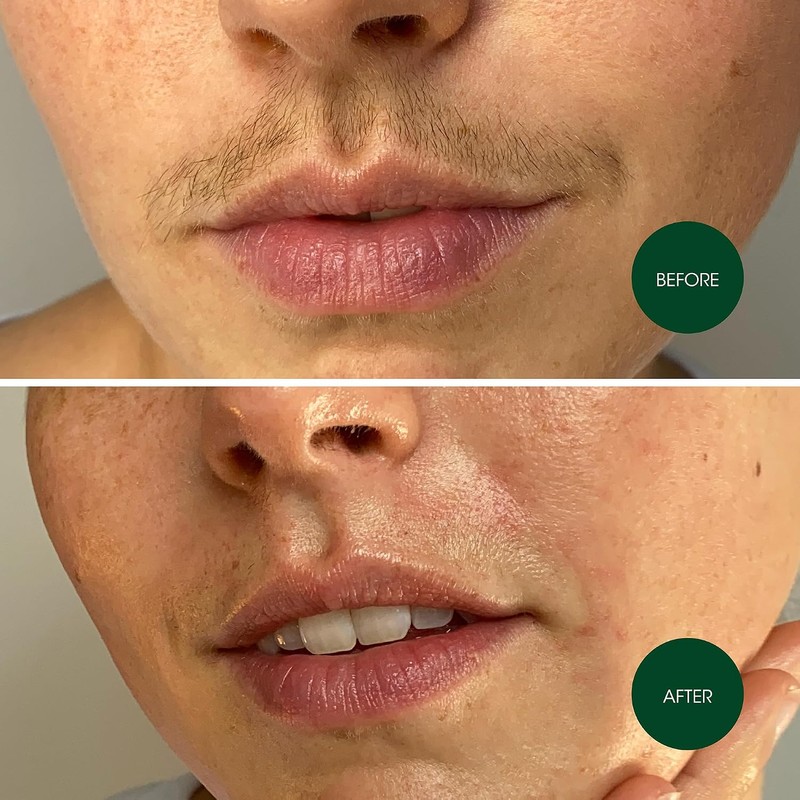 NAD's 20 Piece Facial Wax Strips