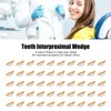 50pcs Teeth Interproximal Wedge Stainless Steel Heat Resistant Dental Matrix