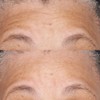 Perricone MD Hypoallergenic Clean Correction Barrier Repair Nourishing Moisturizer, 2