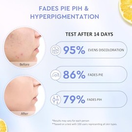 crema facial hidratante e iluminadora con Yuja y Symwhite 377, gel cream para tono desigual y Panthenol para piel sensible, 100 g