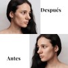 Kit Tratamiento Acné Lilo Skincare Té Verde Y Niacinamida