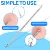 Teenitor Pimple Extractor Acne Treatment Tool Surgical Grade Blackhead Comedone