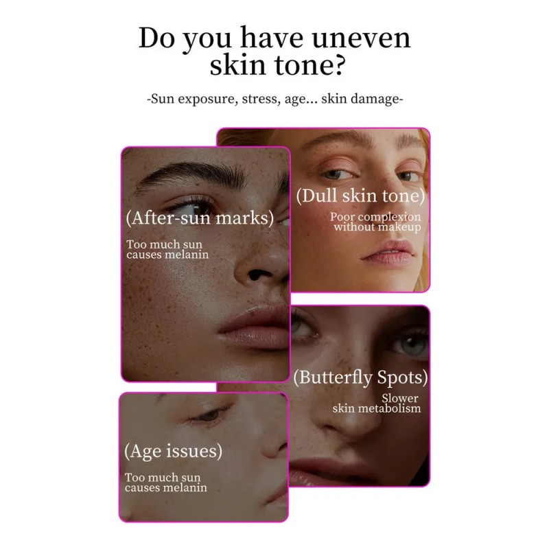Crema Reparadora De Manchas Oscuras Tranexamic Para Rostro Z