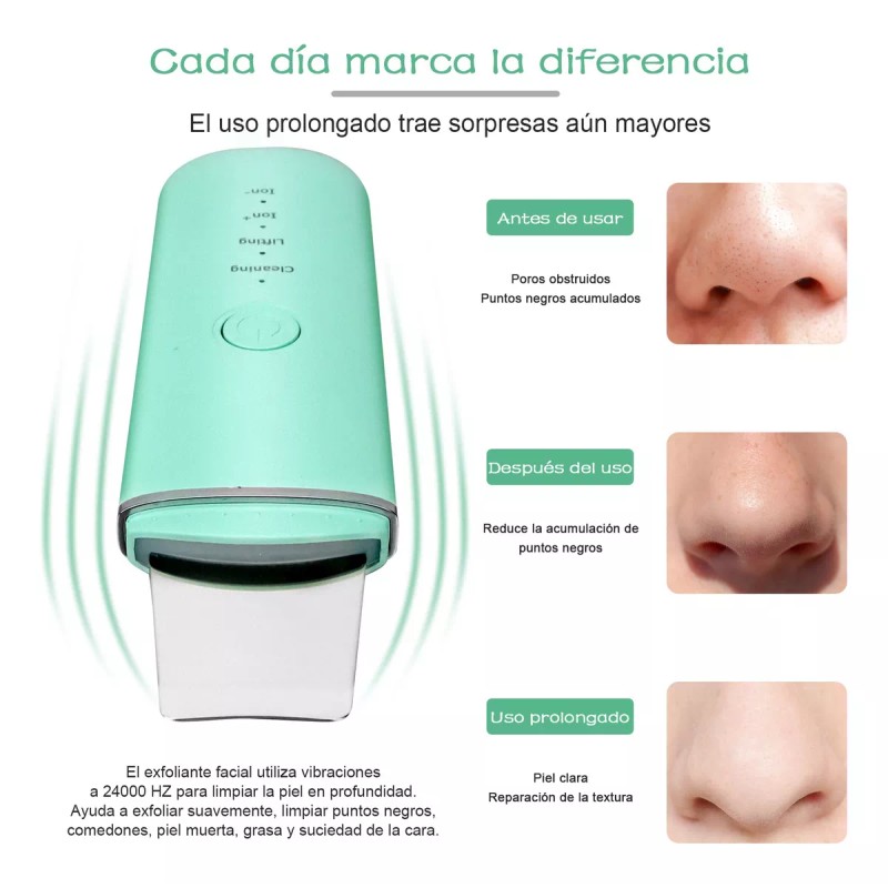Monstyle Limpiador Facial Skin Scrubber Peeling Ultrasónico Portátil