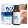 Líquida De Eliminación De Verrugas Y Mezquinos 30ml