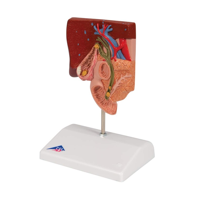 3B Scientific Human Anatomy - Gallstone Model + Free Anatomy