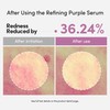 LAGOM Cellus Refining Purple Serum, 10% Azelaic Acid, Ceramide&Panthenol, Herb