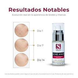 Acne Away Crema Aclarante Anti Acne 40 ml