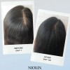 Nioxin 1 Scalp And Hair Treatment -tratamiento 100ml