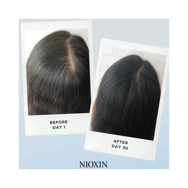 Nioxin 1 Scalp And Hair Treatment -tratamiento 100ml