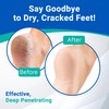 Dermal Therapy - Heel Care Cream, Foot Cream for Dry