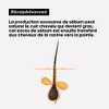 L'Oréal Professionnel Scalp Advanced Shampoo Anti-oleosidad 500ml