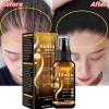 Unbranded Biotin Hair Growth Spray Anti Hair Loss Fast Regrowth