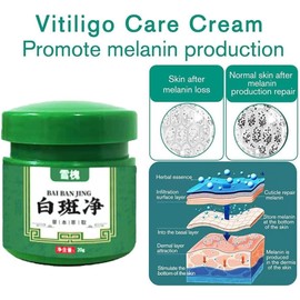 Crema De Vitíligo, Crema De Vitíligo Para La Piel Vitíligo, Cream Para El Cuidado Del Cuerpo, Cremas Reguladora De La Pigmentación Para Psoriasis, Leucoplasia, Vitíligo Desvanecido (Paquete de 5)