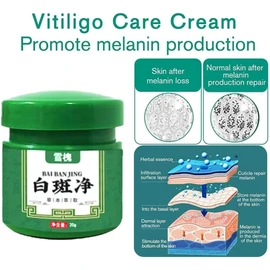 Crema De Vitíligo, Crema De Vitíligo Para La Piel Vitíligo, Cream Para El Cuidado Del Cuerpo, Cremas Reguladora De La Pigmentación Para Psoriasis, Leucoplasia, Vitíligo Desvanecido (Paquete de 5)